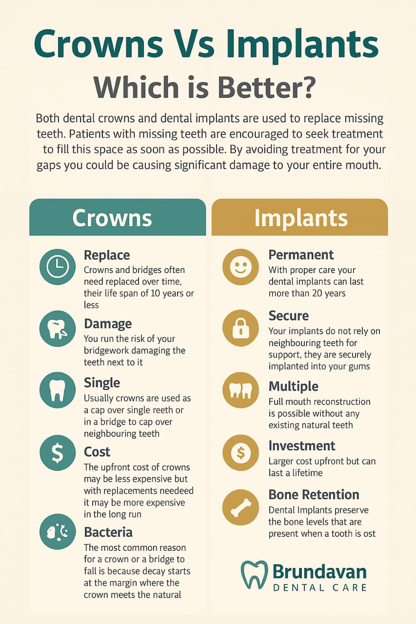 Dental Implants